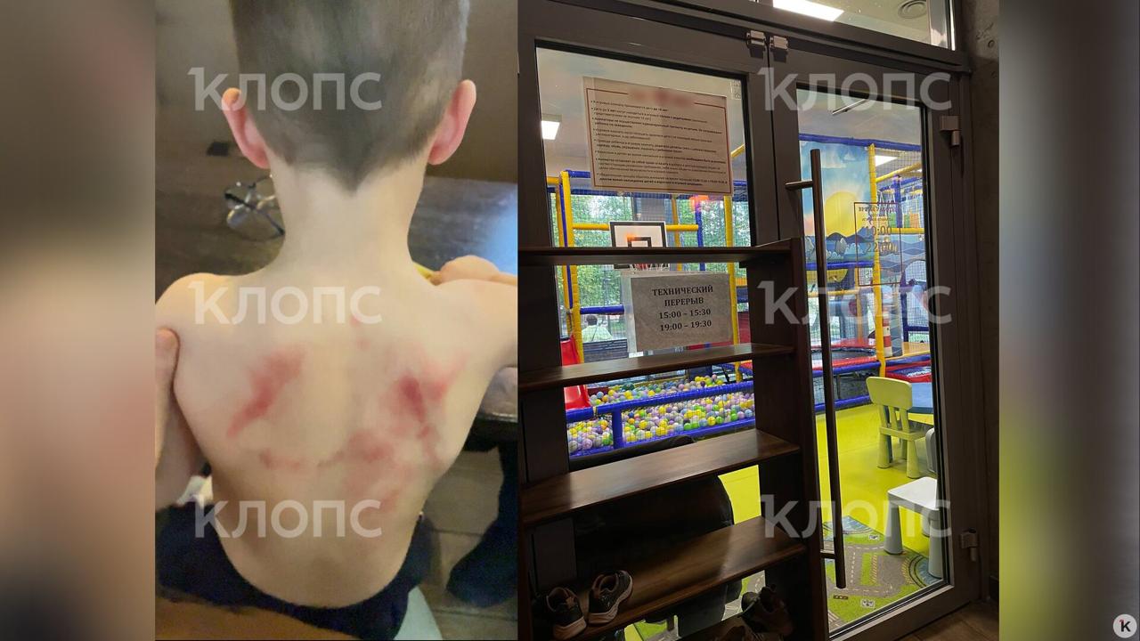Прокуратура требует взыскать 100 тысяч рублей с кафе, где в детской комнате избили ребёнка