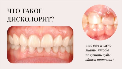 ��� ������� ���������� ������� ������: ������� ������������