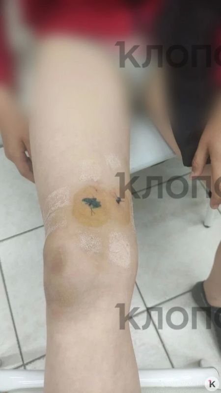 В Чкаловске стаффорд без поводка покусал двух 9-летних мальчиков В Чкаловске стаффорд без поводка покусал двух 9-летних мальчиков