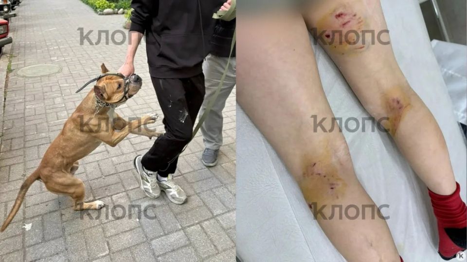 В Чкаловске стаффорд без поводка покусал двух 9-летних мальчиков В Чкаловске стаффорд без поводка покусал двух 9-летних мальчиков