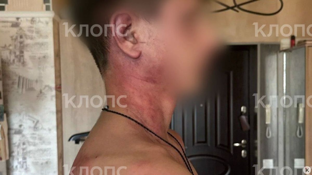 «Мама, это папа. Он был пьяный»: 14-летнего сына калининградки зверски избил и едва не задушил бывший муж