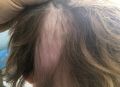 В Калининграде мужчина вырвал волосы с головы 15-летнего подростка