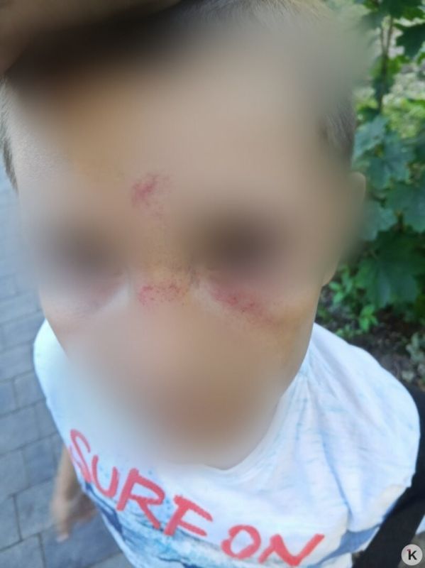 В Васильково женщина ударила 8-летнего мальчика, который поссорился с её дочкой