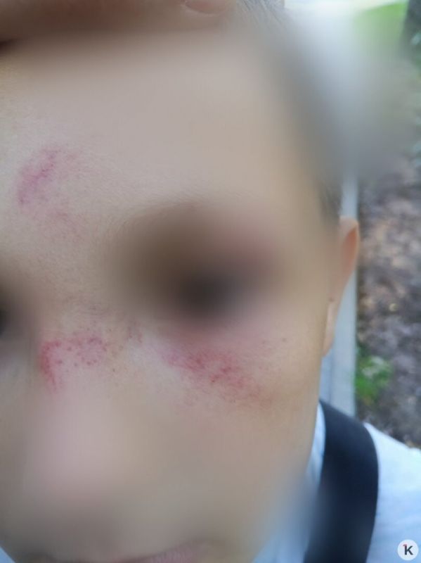 В Васильково женщина ударила 8-летнего мальчика, который поссорился с её дочкой В Васильково женщина ударила 8-летнего мальчика, который поссорился с её дочкой