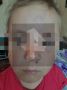 Пятилетняя девочка получила сотрясение мозга в детсаду в Калининградской области — её мать-воспитатель отказалась от госпитализации дочери, рассказал РЕН ТВ отец ребёнка